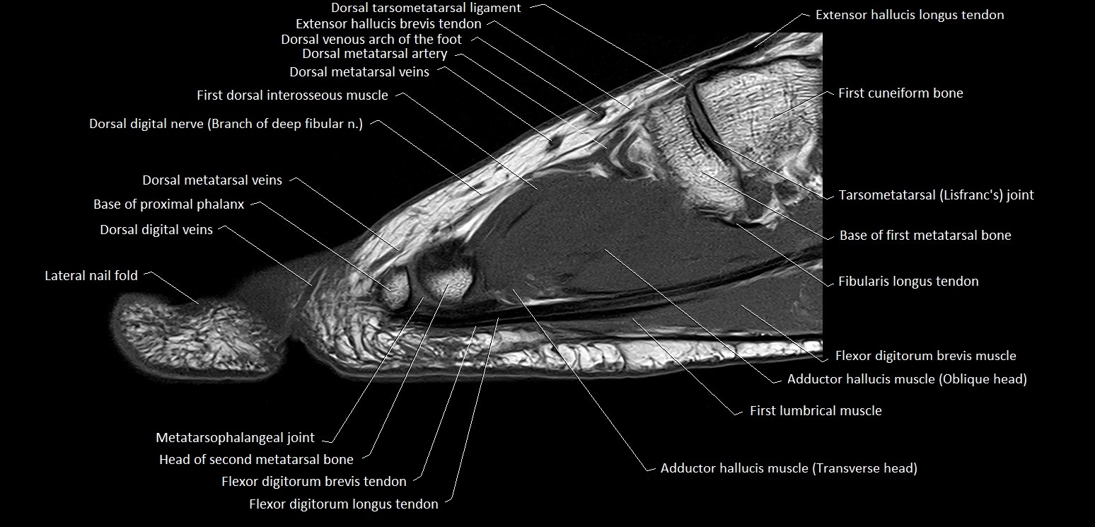 Hallux or big toe sagittal anatomy 3T MRI image 20.webp